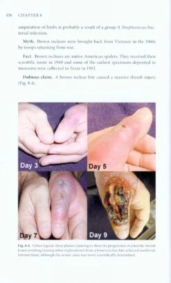 The Brown Recluse Spider 11 The Brown Recluse Spider -Wildlife Professional Books 220427 3