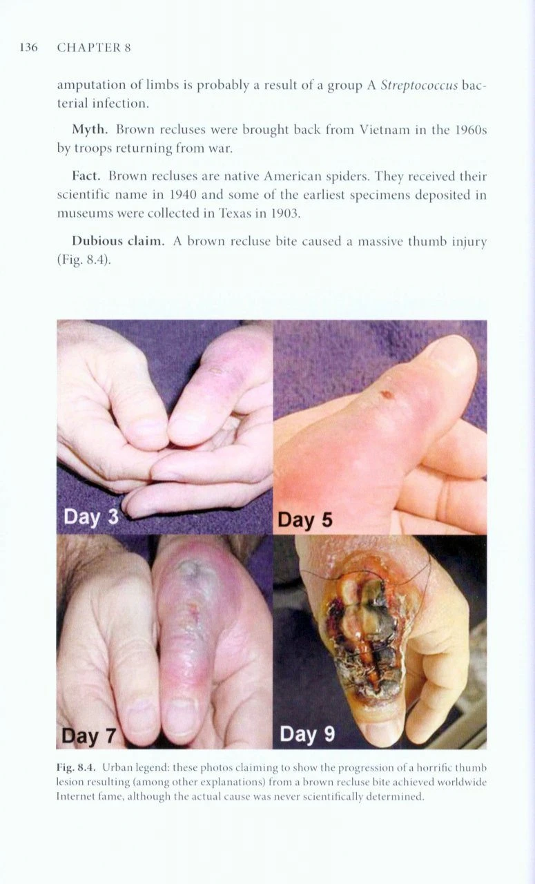 The Brown Recluse Spider 6 The Brown Recluse Spider - Image 4